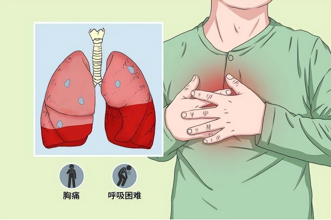 空气中的气体科普,空气栓塞科普