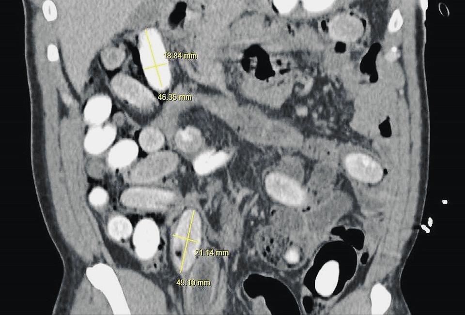 人口*市黑**有多可怕？当奴工、做*奴性**、割器官，数千万人沦为奴隶