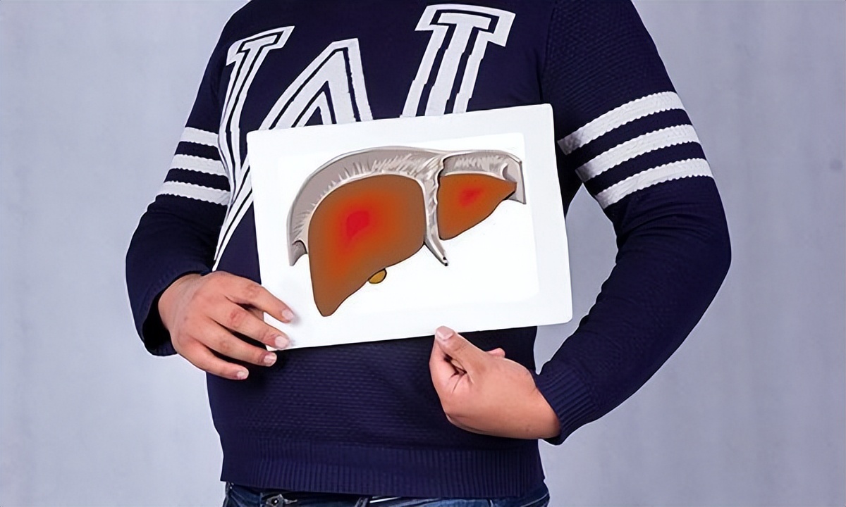 鹅肉是癌细胞的催命符吗,鹅肉对肝硬化有害吗