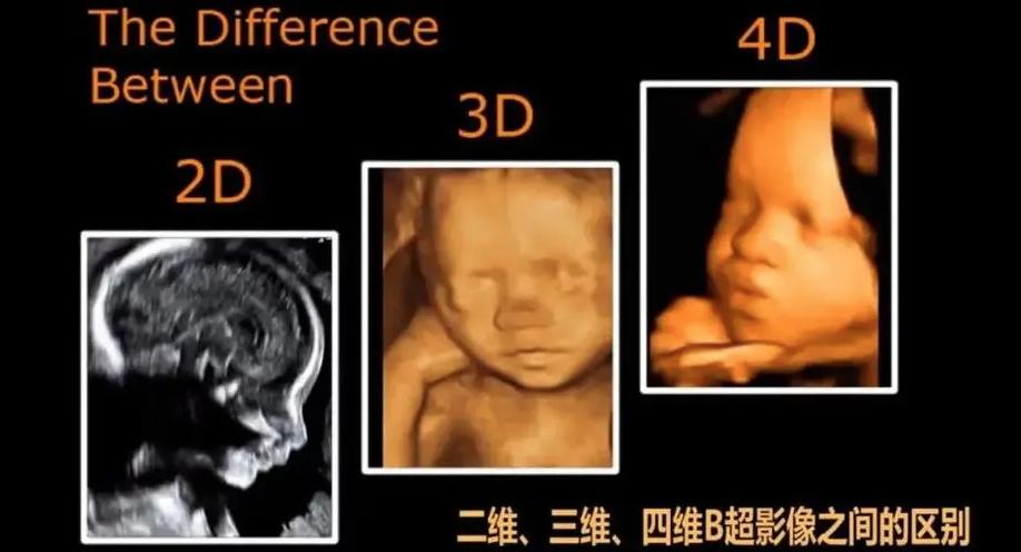 科普视频产检到底检什么,产检四维是检查什么