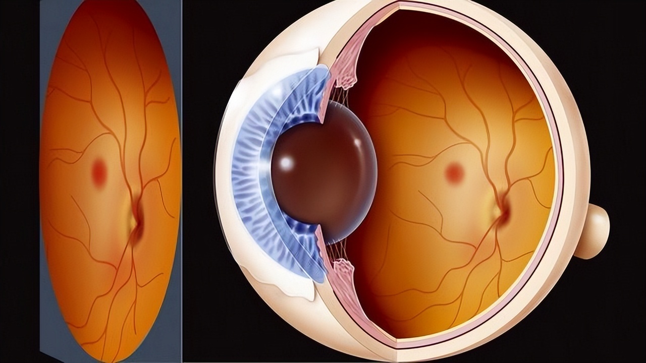 糖尿病病人可以吃羟苯磺酸钙吗,羟苯磺酸可以预防糖尿病并发症吗