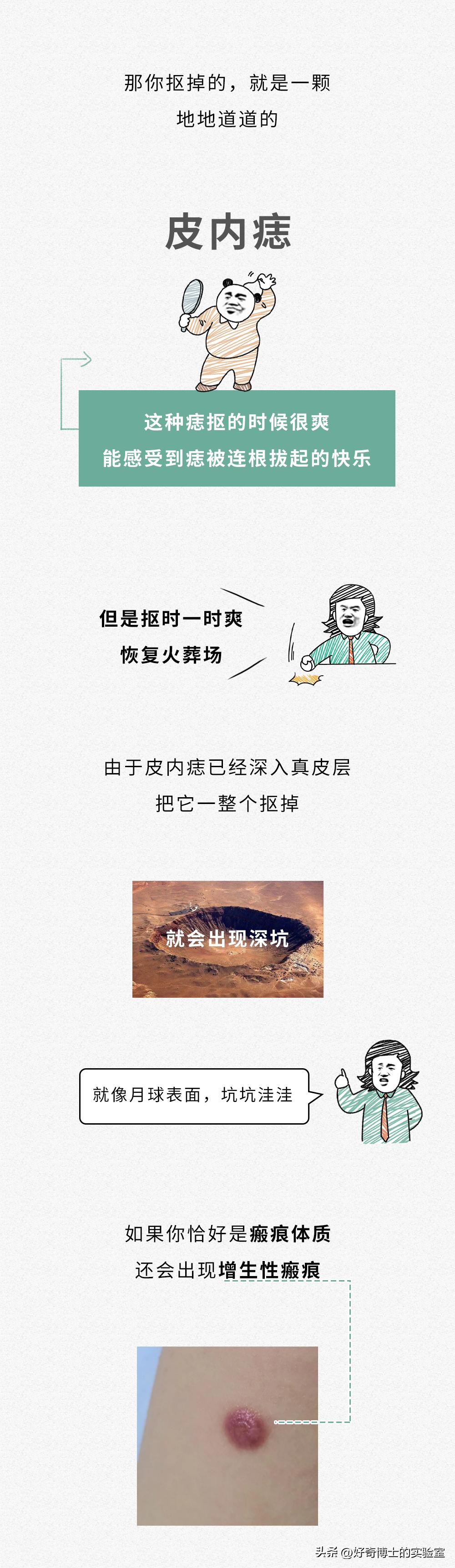 身上的痣被抠掉了会发生什么事情,身体上的痣可以抠掉吗