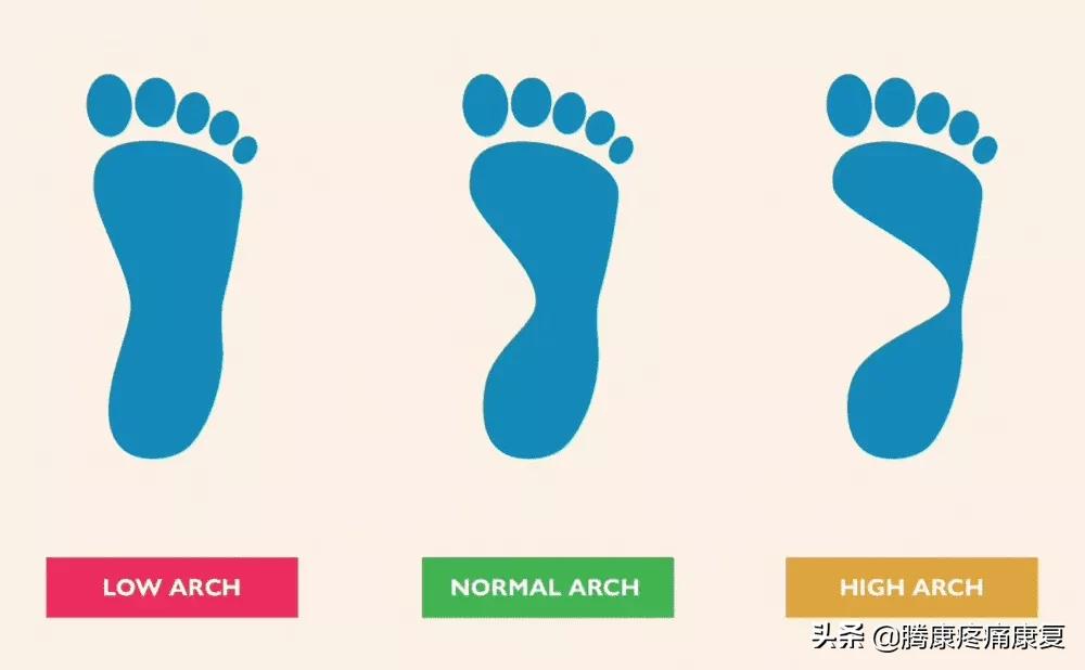 功能性高足弓的练习方式,足弓疼痛3个动作缓解