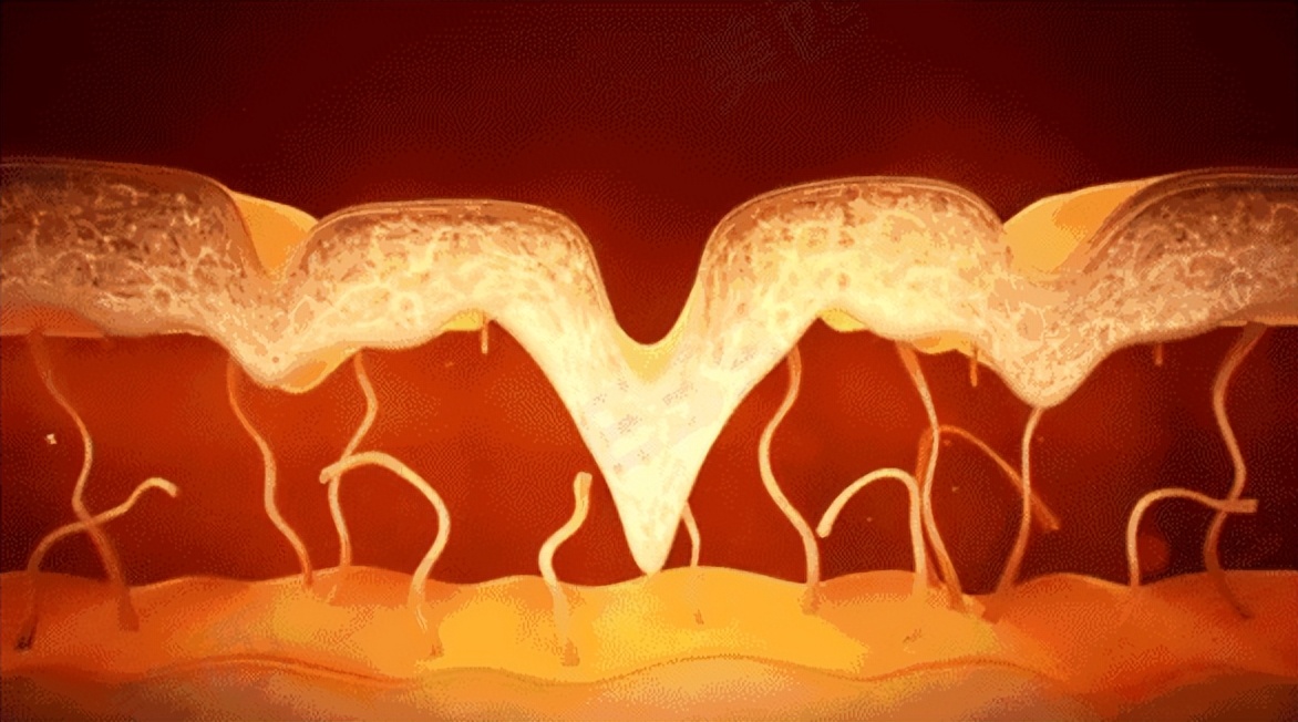 医美常见的医美手段包括光子嫩肤,第一次做医美先祛斑还是光子嫩肤