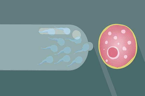避孕套一两百的为什么那么贵,避孕套10元和30元的有什么区别