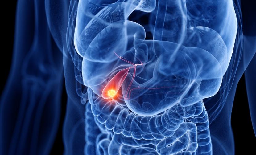 胆囊切除后对人体影响很大,胆囊切除对人体器官影响大吗