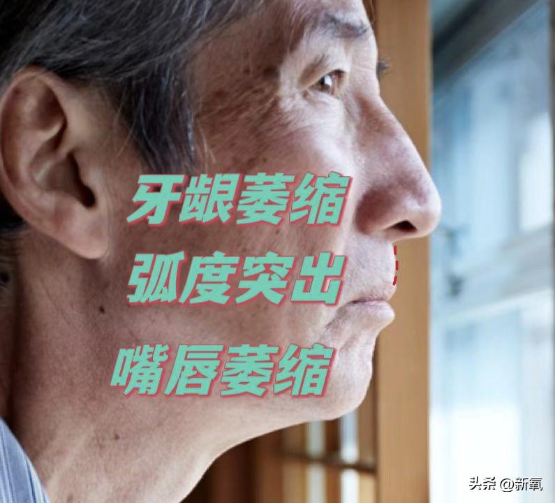 嘴唇薄变丰满,嘴唇变凸变丑怎么办