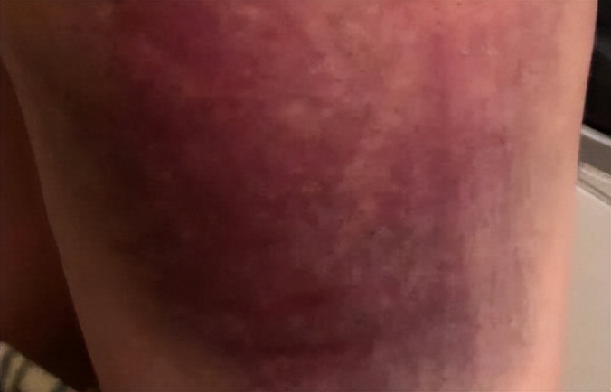 莫言的《丰乳肥臀》：本是献给母亲的赞歌，为何长时间沦为*书禁**？