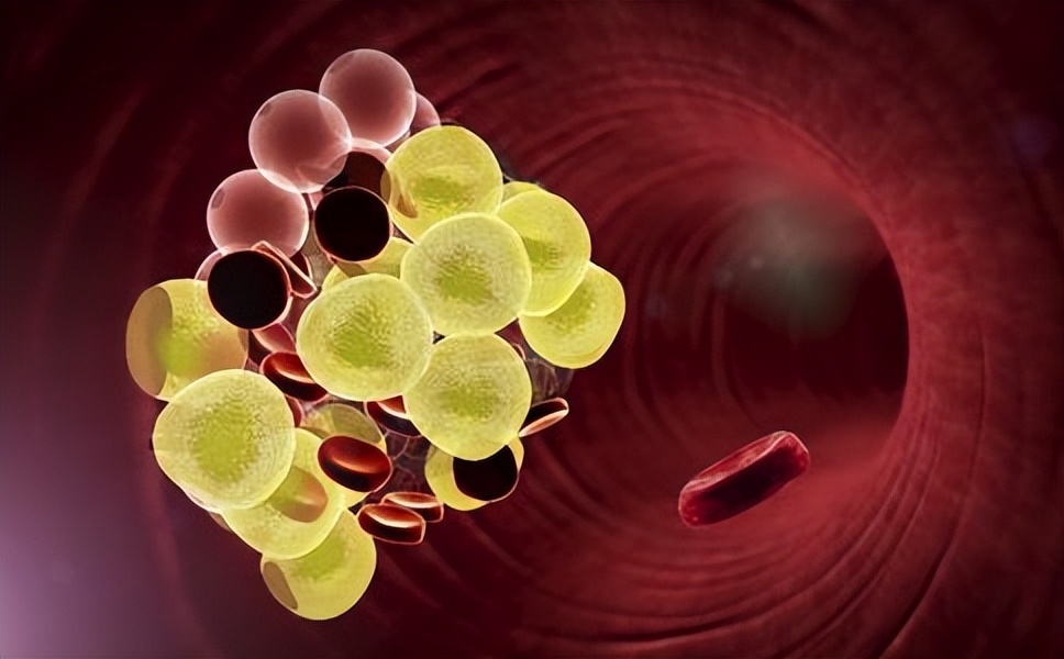 30岁转氨酶114吃护肝的药能好吗,转氨酶66降到40的最好方法