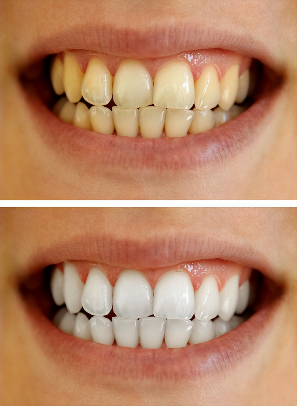 牙缝中抠出黄黄的东西,又软又臭,究竟是什么东西?看完长知识了