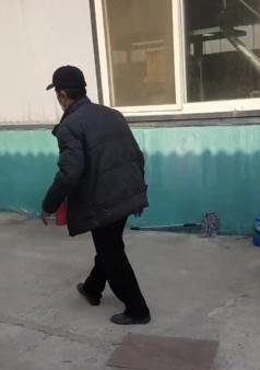 脑外伤后硬膜下积液颅骨修补,颅骨修复手术失败导致脑积水