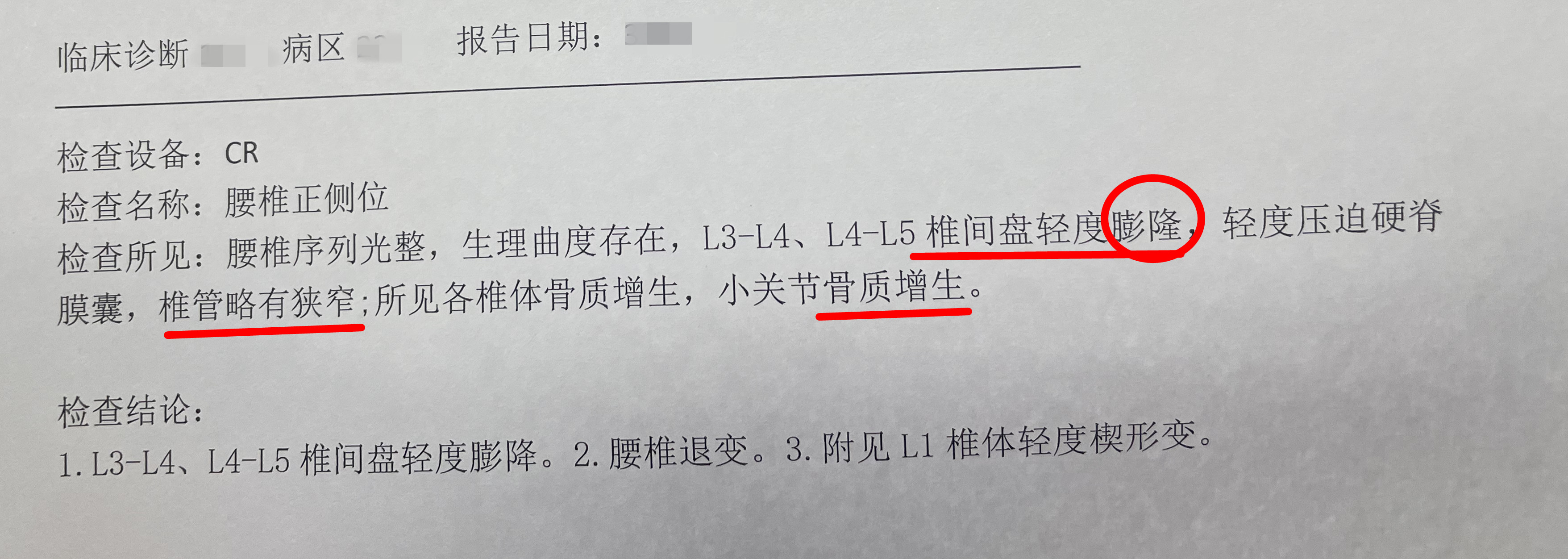 骨科保守治疗那些事,骨科医生看ct片子说没什么事