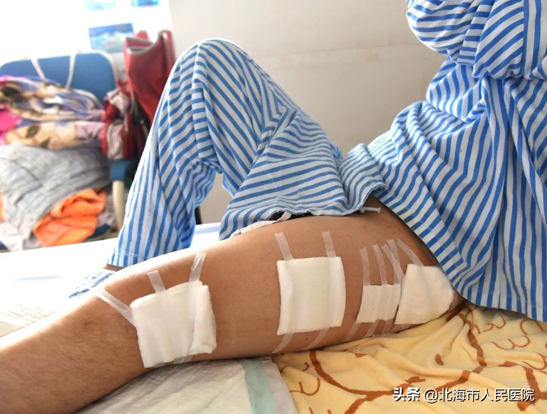 男子足球撞门柱,男子踢球被断球摔倒骨折