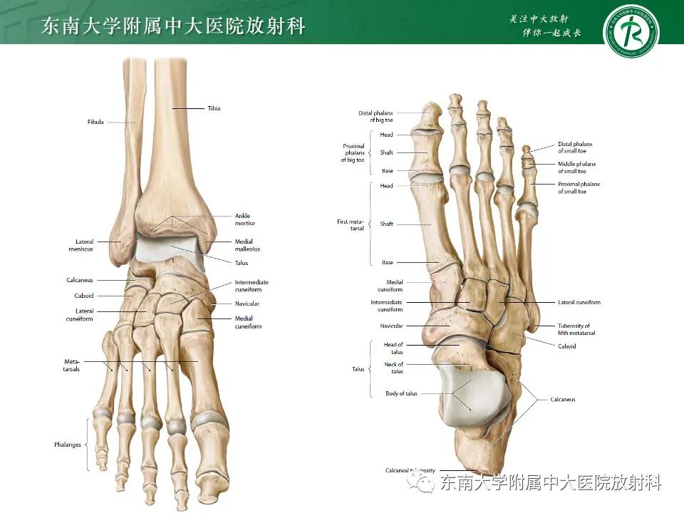 好文分享-《肌骨系统疾病——副舟骨综合征》