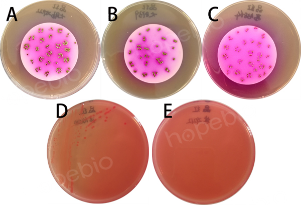 大肠埃希氏菌检验,水中大肠埃希菌的五种类型鉴别