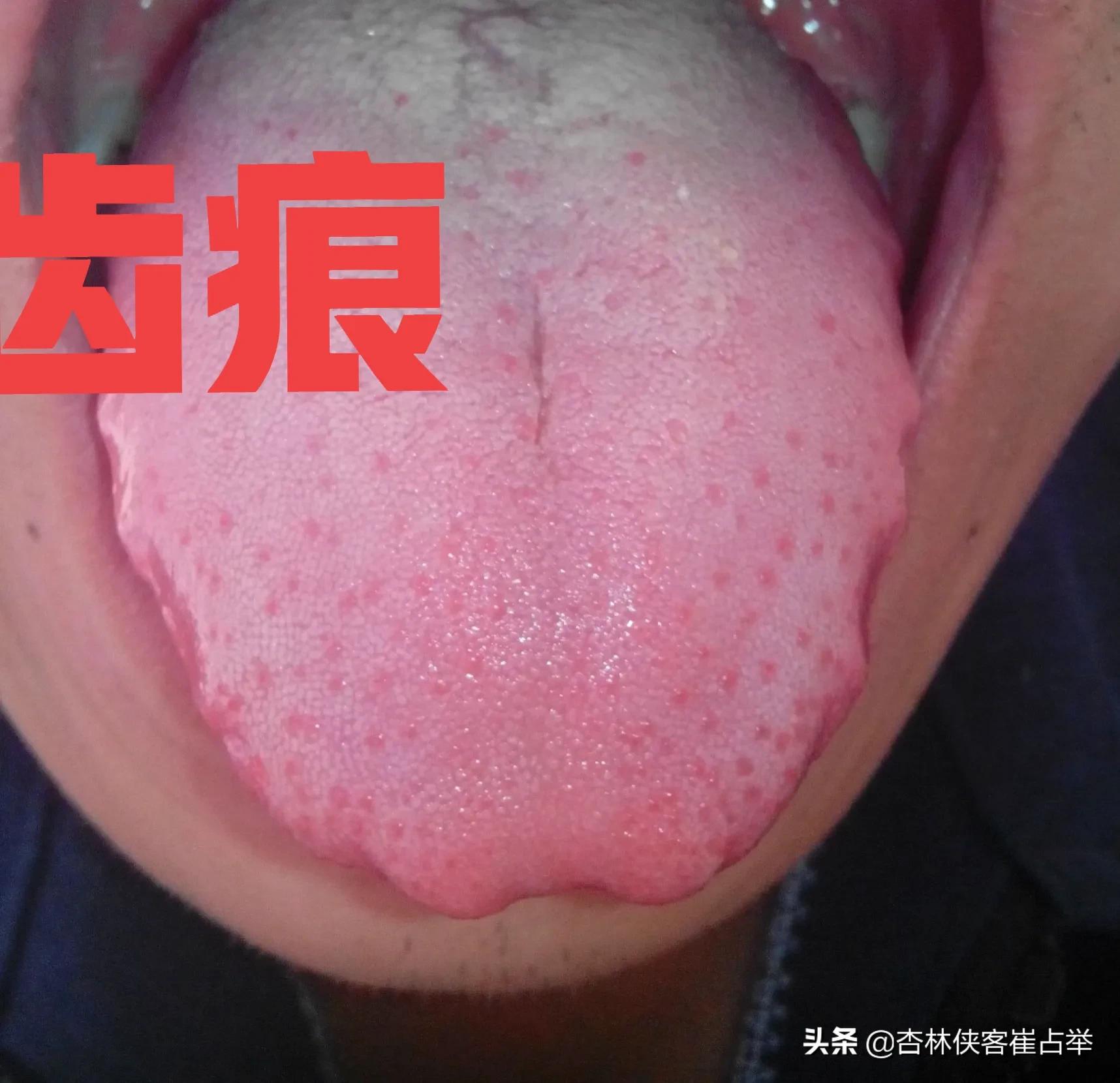 一味中药调整脾肾虚,肾虚脾胃不和最好的调理方法