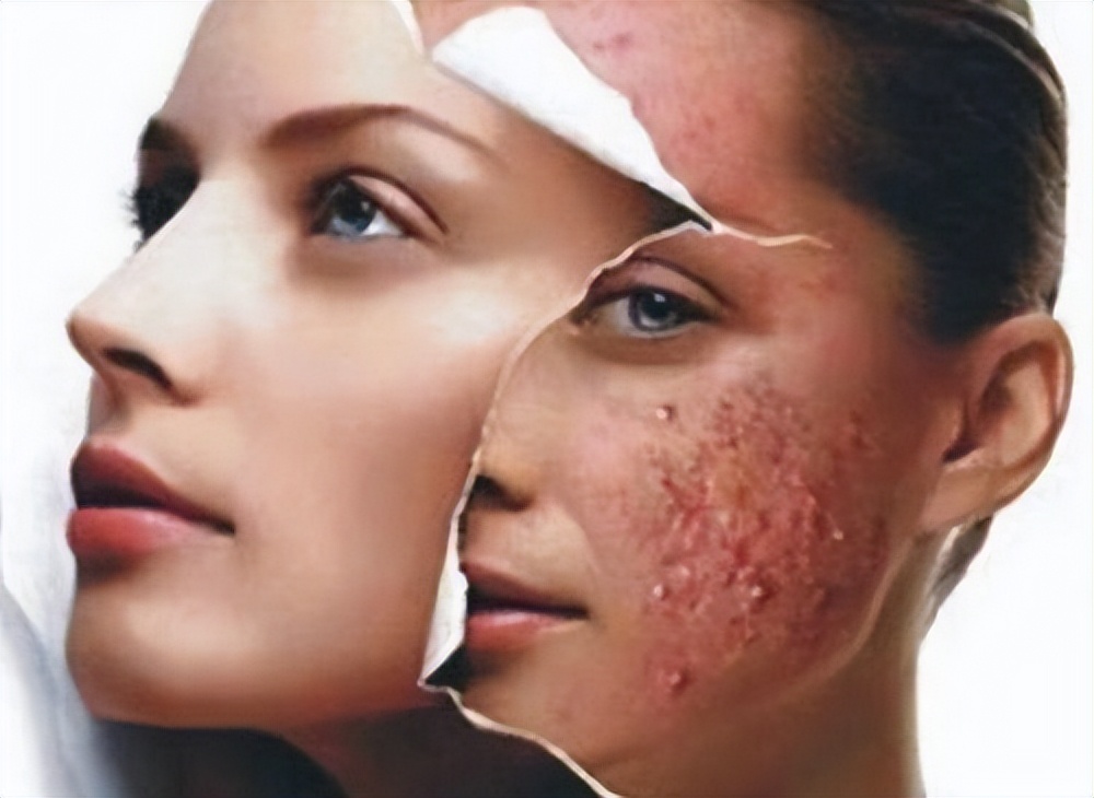 身体五个现象说明盐摄入过多,食盐摄入量少身体会出现哪些症状