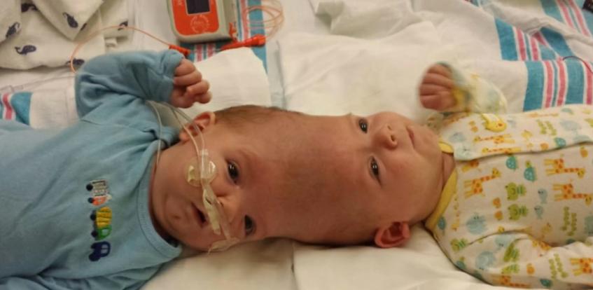 10种怪异的两个头动物,10种变异双头动物