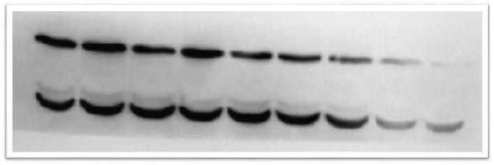wb试验有条带为什么曝光,wb实验第二条带消失了