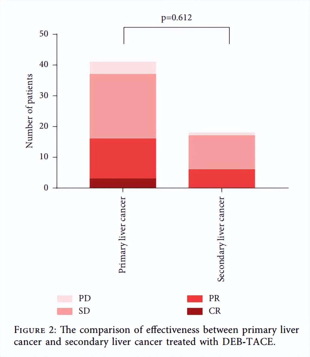 什么是原发性肝癌tace治疗 (tace是肝癌非手术治疗的首选疗法)