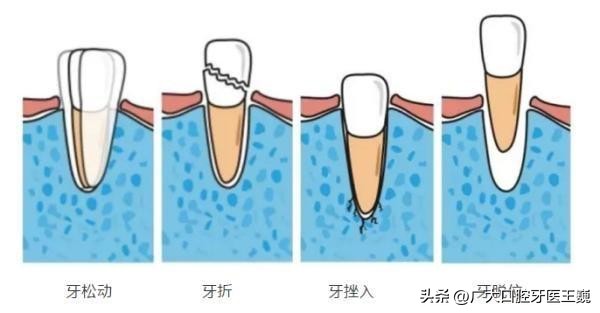 牙疼想知道自己是哪种牙疼,牙疼不是病疼起来简直真的要人命