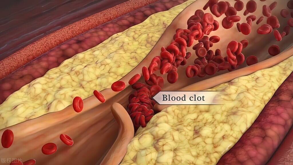 老年人每年打针疏通血管有好处吗,打什么针可以清理血管垃圾