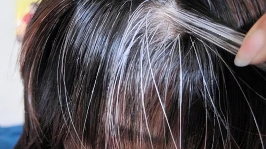 阴毛有什么用，要不要刮掉？阴毛的变化可能暗示什么疾病？望了解