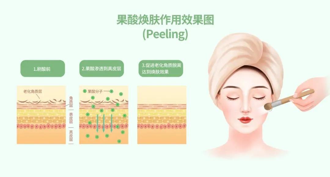 果酸换肤后脸毁了怎么办,果酸到底怎么用