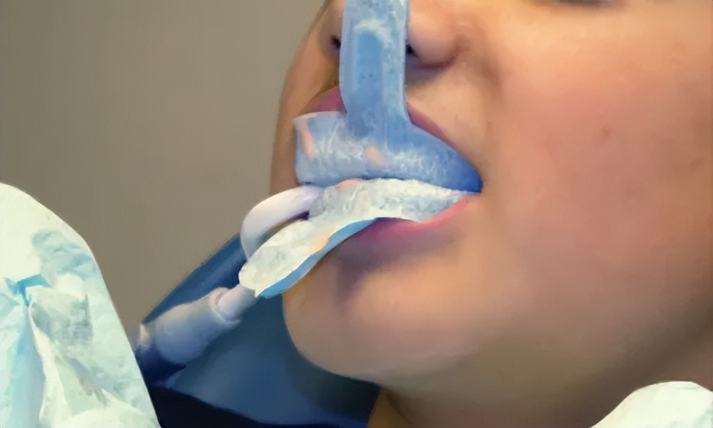 涂氟时候小孩不配合,宝宝2岁涂氟不配合