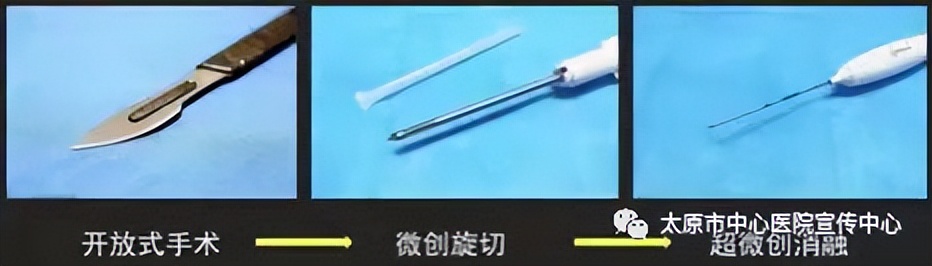 微波消融术可以治乳腺癌吗,乳腺结节微波消融术多少钱一次