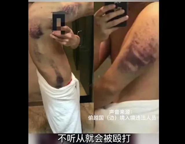网传李赛高“挑脚筋”，他宣传的缅北你还心向往之吗？