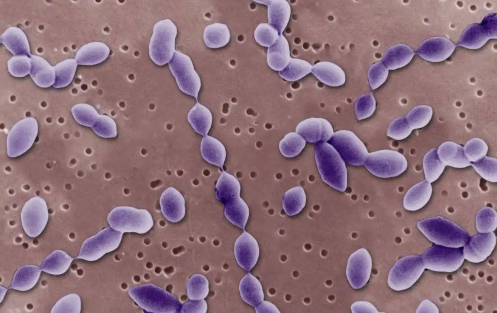 只通过性传播的病,哪些病是通过性传播的