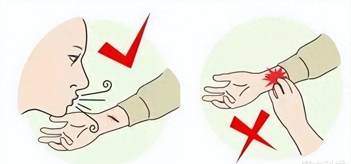 硫酸虫咬了怎么处理,硫酸虫导致皮肤损伤处理