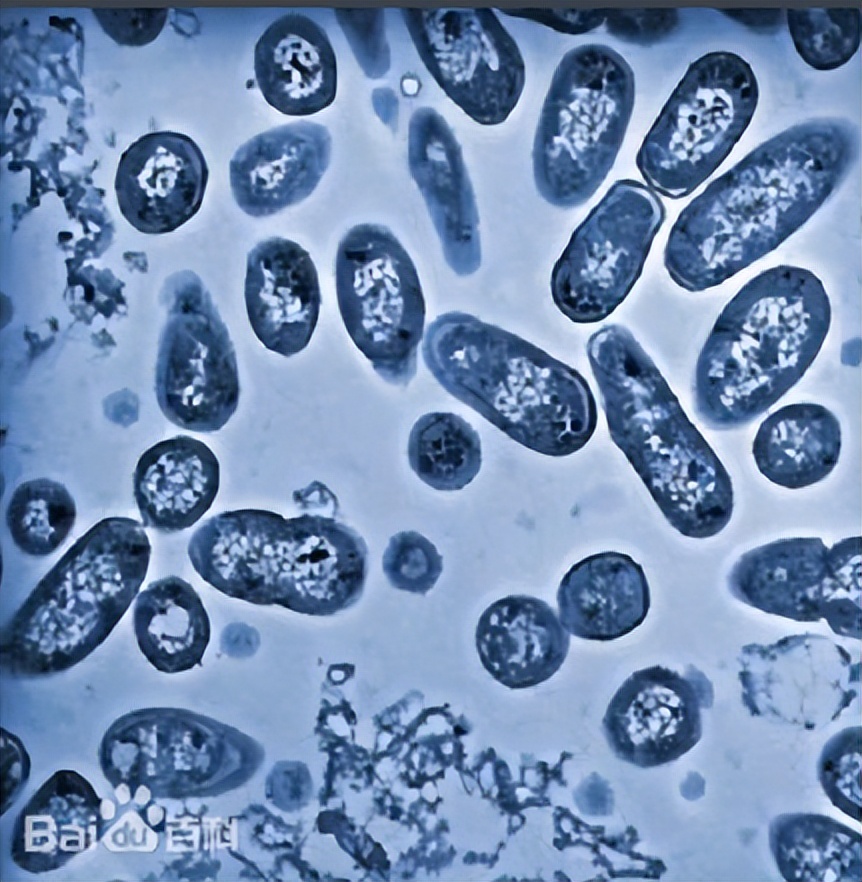 牛沙门氏菌,牛感染沙门氏菌怎么治疗