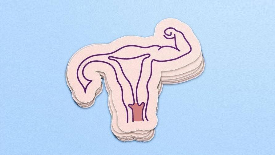 宫颈炎是什么原因引致的,宫颈炎诊断讲究三步走