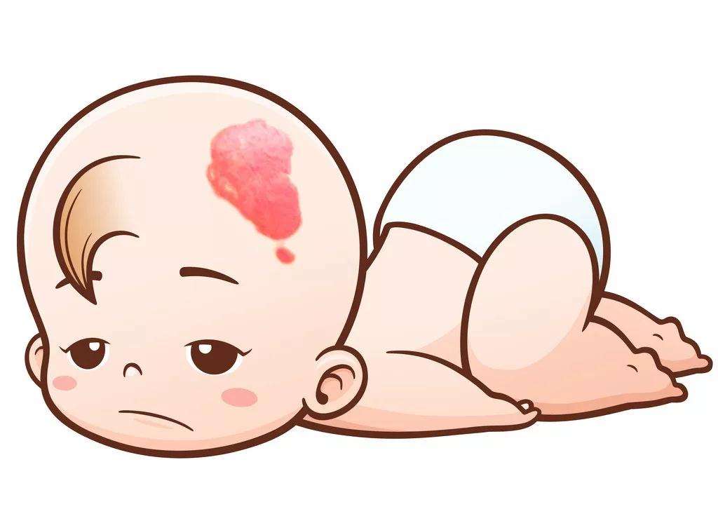 宝宝身上的记号,宝宝身上的小点点密密麻麻很淡