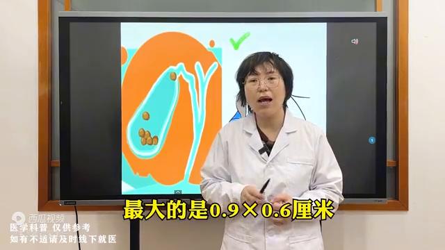 胆结石睡觉姿势朝哪边睡比较好,胆结石人睡觉往左侧还是往右