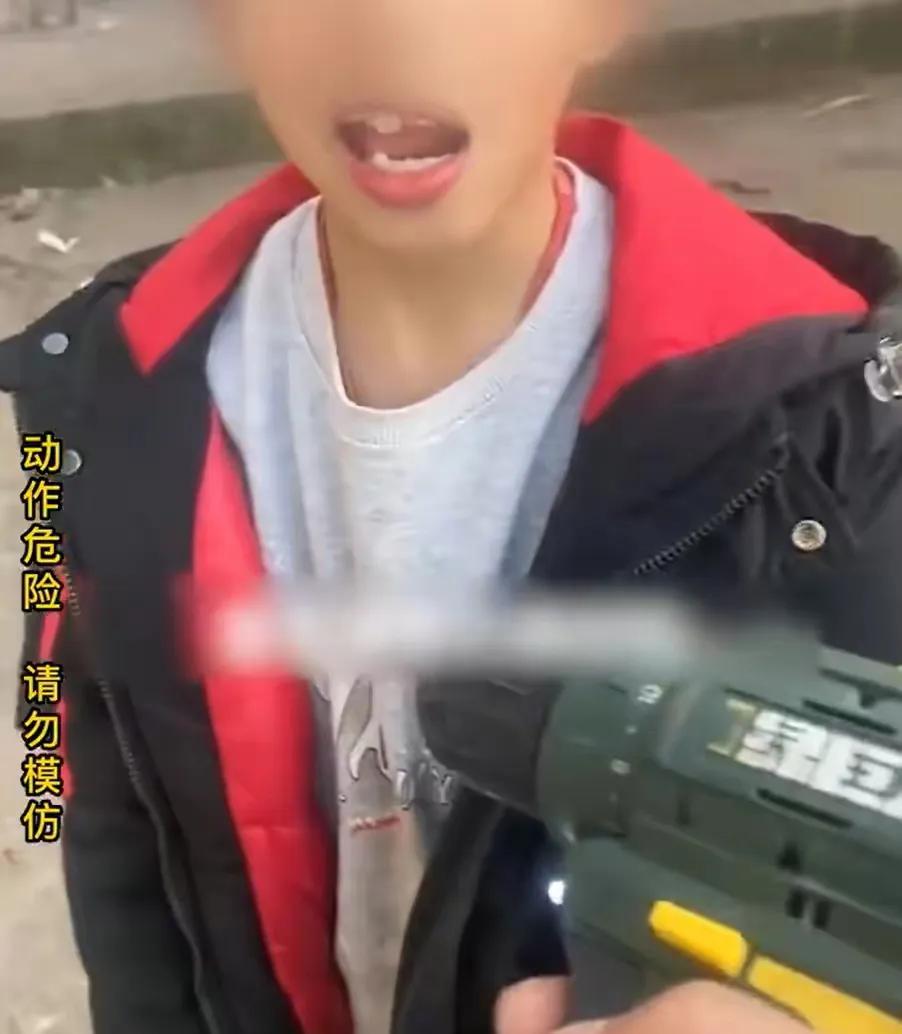 小男孩得了蛀牙必须拔牙,爸爸用电钻给儿子钻蛀牙后续