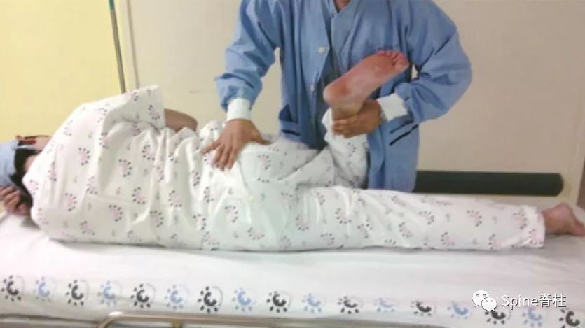 针灸治疗梨状肌综合征,一文了解贲门失弛缓症