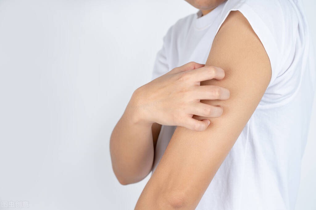 湿疹反反复复的最佳治疗,湿疹反反复复不好怎么调理