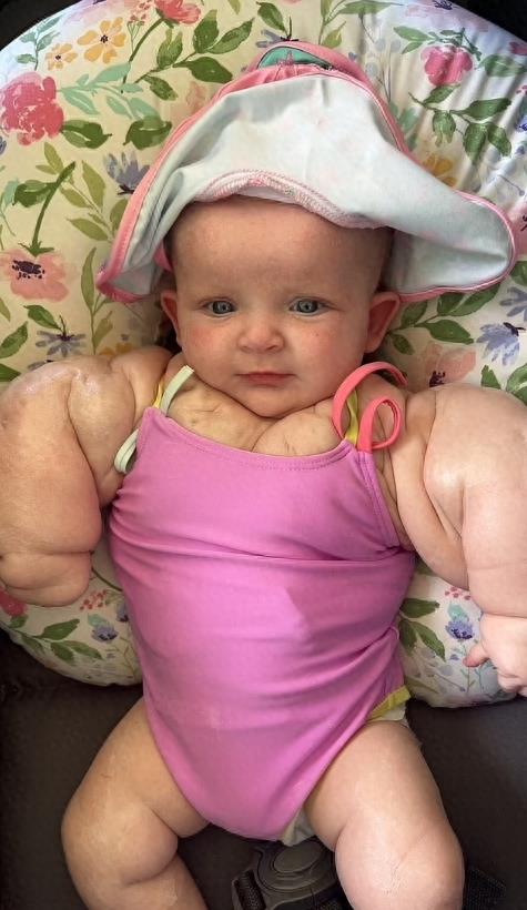 美国婴儿女孩,美国女婴身体患绝症