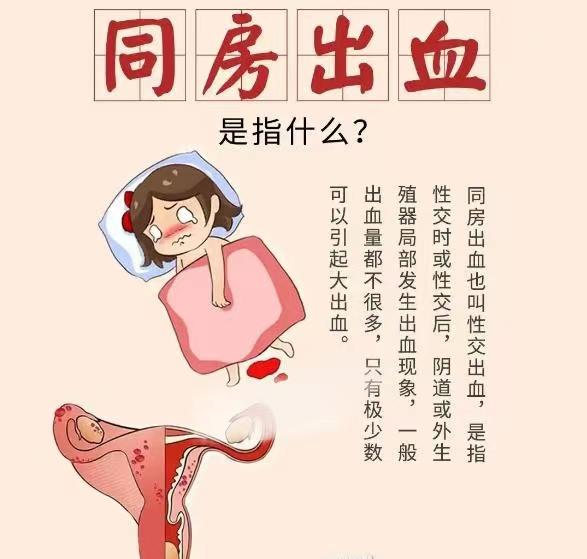 杭州少女大出血,杭州25岁女孩突然大出血