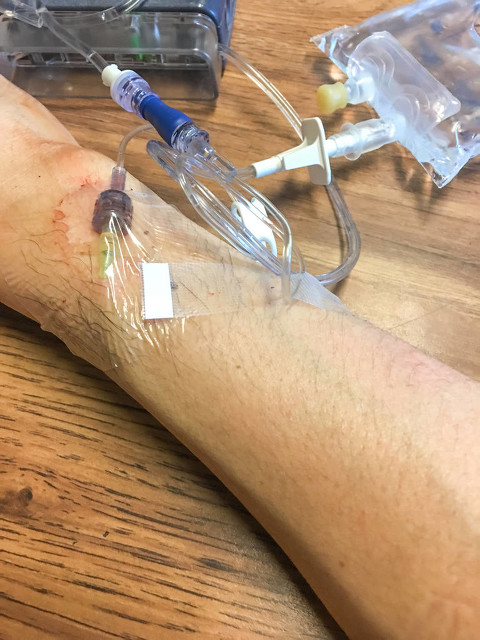 25岁男子确诊肝癌三个月后离世,老人肝癌从确诊到离世