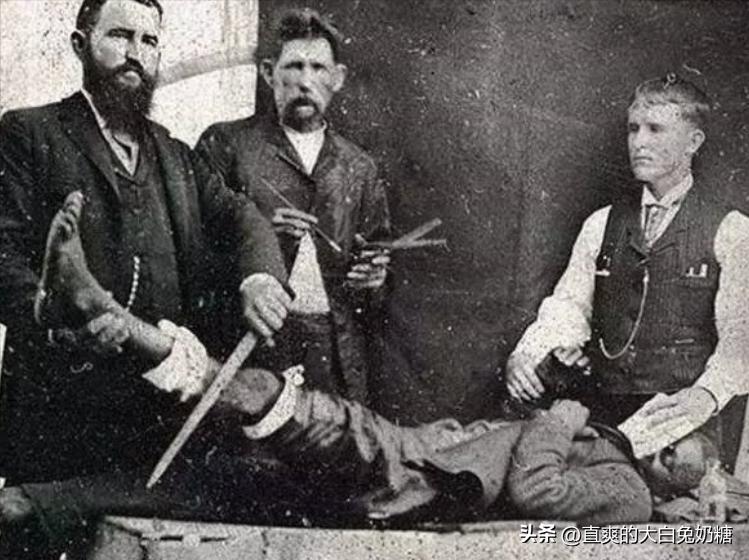 李亚诺断骨增高怎样了,断骨增高手术的李亚诺现状