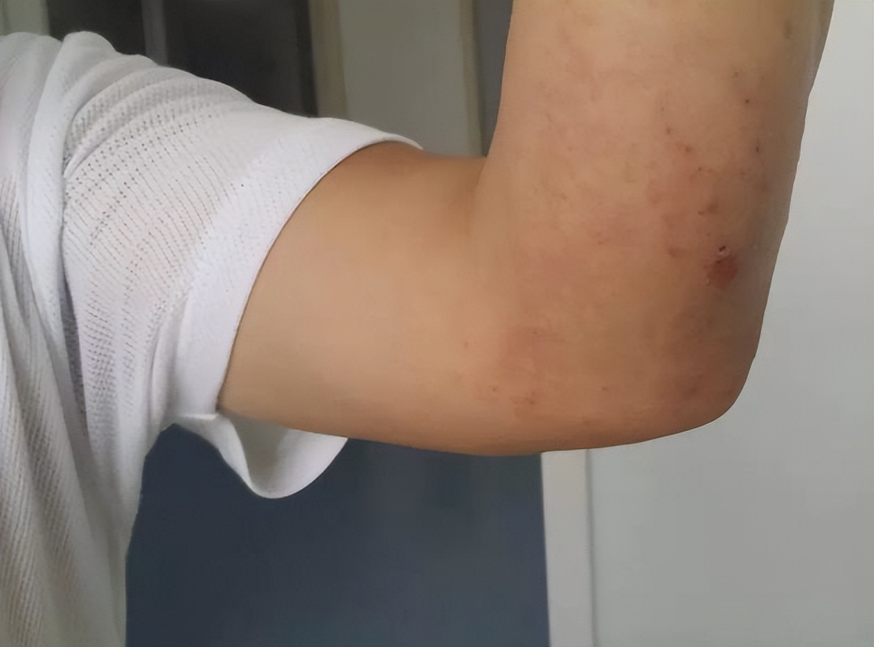 一旦感染艾滋病多久能检测出来,一旦感染艾滋多久出现症状