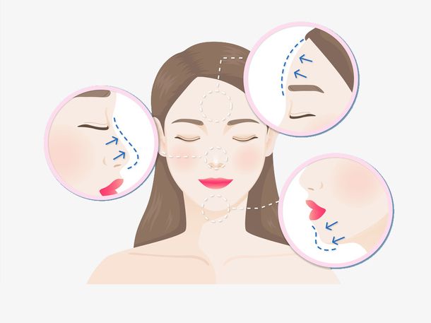 割双眼皮母女阴阳相隔,美容院母女俩割眼袋事件