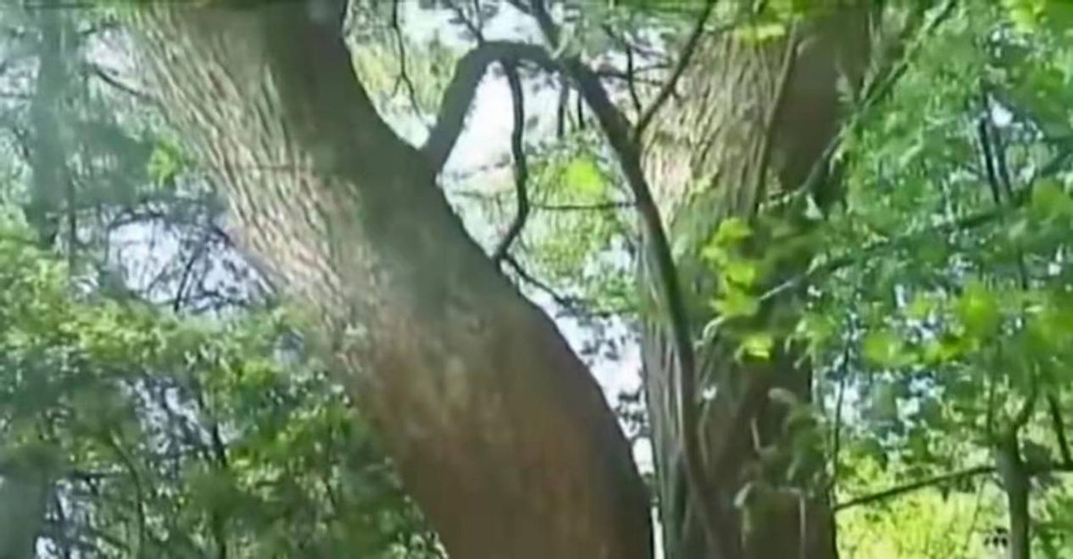 男子手长满树疙瘩是什么病,男子手长满树疙瘩手术了吗