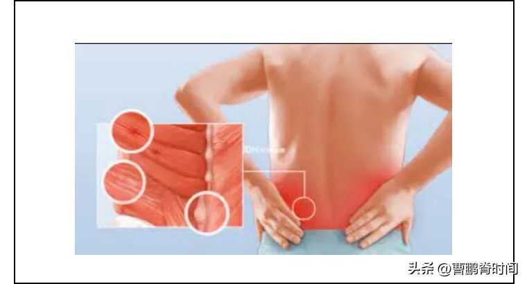 经常腰痛怎么办教你四招放松腰部,腰痛后如何让腰快速恢复正常