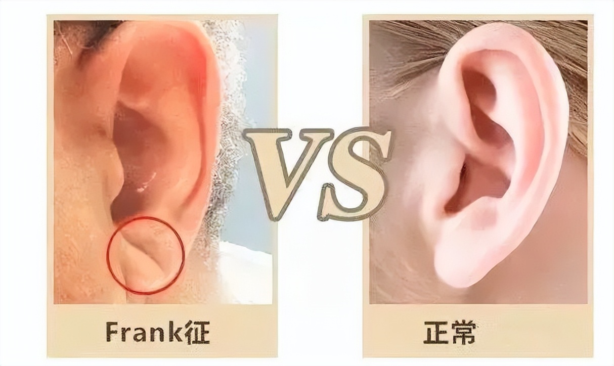 北京协和医院外科健康科普视频,协和医院健康科普