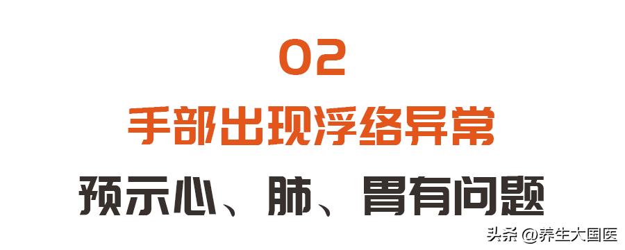 手脚血管突然明显凸起,心脏血管三高怎么预防